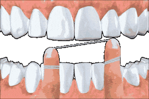 Teeth Dentist GIF