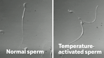 Sperm GIF