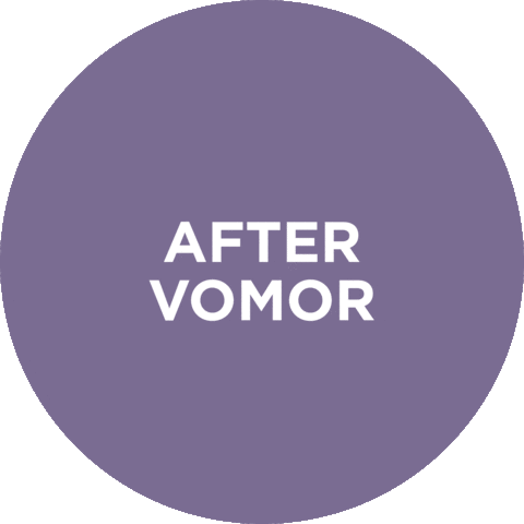 Before And After Hair Extensions Sticker by VoMor