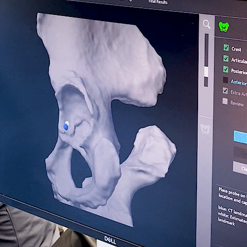 Orthopedicsurgery Orthopedicsurgeon Bonedoc Bonedoctor GIF by CoryCalendineMD
