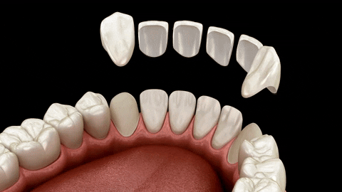 DentalArte giphyupload GIF
