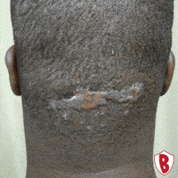 Before And After Transformation GIF by Dr. U Hair and Skin Clinic