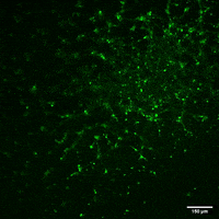 Microscopy Bipolar Disorder GIF by Wyss Institute