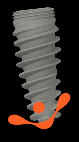 singularimplants giphygifmaker odontologia singularimplants GIF