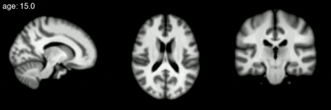 adamconner-simons giphygifmaker GIF