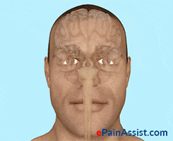 head and face injuries GIF by ePainAssist