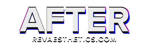 After Result Sticker by REV Aesthetics