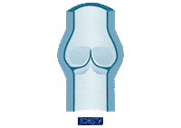 EssityBr saúde fisioterapia medico esporte Sticker