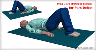 lying down stretching exercise for pars defect GIF by ePainAssist