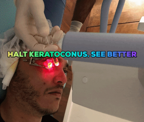 rkmd giphygifmaker cxl intacs keratoconus GIF