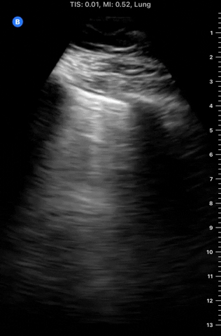 PocusMed giphyupload GIF