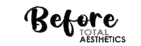 Lip Fillers Sticker by total aesthetics