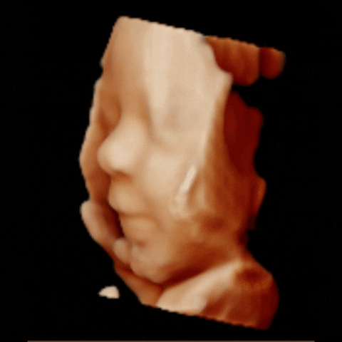3dechobarendrecht baby zwanger pretecho 3decho GIF