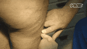 Doctor Queer GIF by VICE En Español