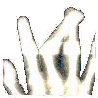 X-Ray Sticker by GAYLE