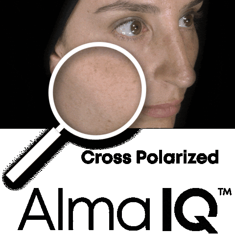 Skin Analyse Sticker by Alma Lasers GmbH