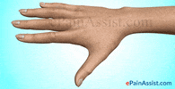 finger injuries information center GIF by ePainAssist