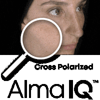 Skin Analyse Sticker by Alma Lasers GmbH