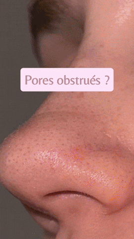 Mimley giphyupload GIF