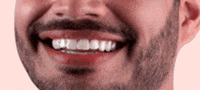 moonsclearaligners  GIF