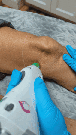 GIF by MidState Skin Institute