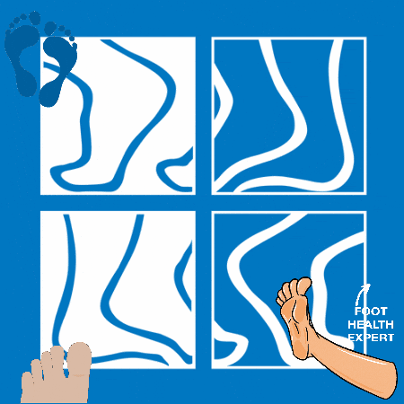 orthoticsAu giphygifmaker giphyattribution GIF