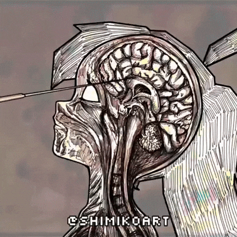 Lobotomy GIF