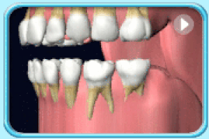tooth GIF