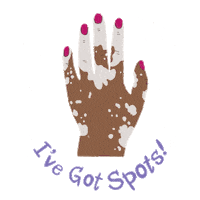 Ivegotspotsbook girl face hand hands Sticker