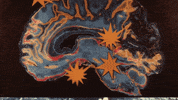 epitaphrecords music music video brain sparks GIF