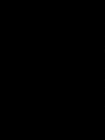 Beneficios Malla Reductora