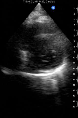 PocusMed giphyupload GIF