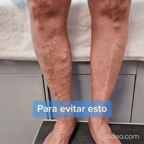 andrsfelipebaloco giphyupload GIF