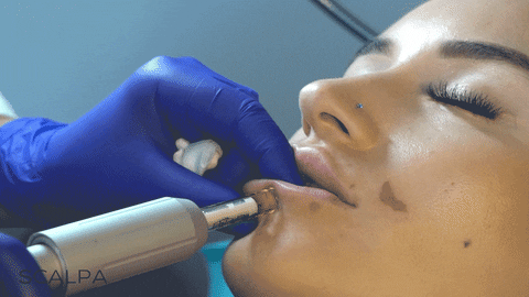 Hyaluronic Acid Lip Injections GIF by ScalpaShop