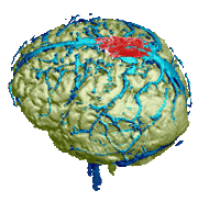 brain STICKER