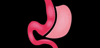 drozgun surgery surgeon sleeve sleevegastrectomy GIF
