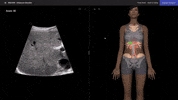 iNNOGING  GIF
