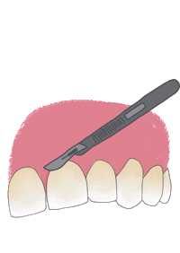 Endo Endodoncia Sticker