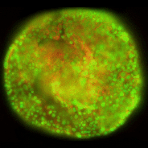 LeicaMicrosystems giphygifmaker thunder cell laboratory GIF