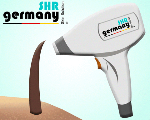 Hair Laser GIF by SHR Germany