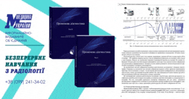 urctmrt giphyupload GIF