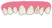 Carillas Protesisdental Sticker