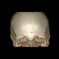 brain scans tech GIF by General Electric