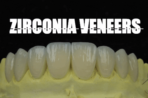 apostoldental giphygifmaker teeth dentistry veneers GIF
