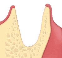 Evolution Rog Sticker by Osteogenos