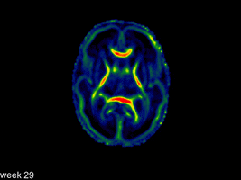 GIF by Imperial College London