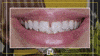 Happy Teeth GIF by The Dental House