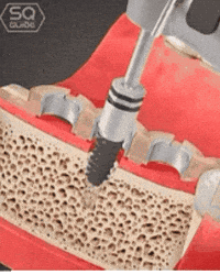 dentisusa dentistry dentis gdia dental education GIF