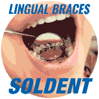 Braces Ortho Sticker by soldent