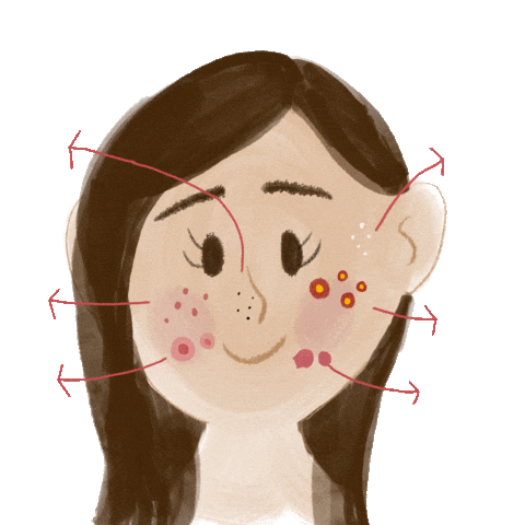Acne Sticker